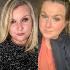 Meet Tonya—she's been using our Transformation Set for just 30 days, and  the results speak for themselves. NO filters. Just REAL, transformative  results backed by our 60-day money-back guarantee. 🙌 ✨ Here's