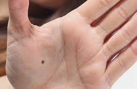 Namun, pernahkan anda terfikir tentang maksud tahi lalat dan rahsia tahi lalat ini? Maksud Tahi Lalat Dan 14 Kaitannya Dengan Personaliti Anda Theasianparent Malaysia