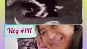 Influencer Eva Rojas anuncia embarazo: “nuestra bebé milagro”