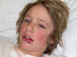 Guisborough family's disappointment as payout is withdrawn for autistic son 