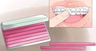 The good news is, all of this gets much better very quickly. How To Take Away The Pain Of New Or Tightened Braces 8 Steps