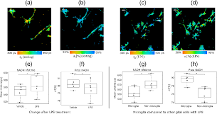 Kunci jawaban brain test level 309 : Microglia Activation Visualization Via Fluorescence Lifetime Imaging Microscopy Of Intrinsically Fluorescent Metabolic Cofactors