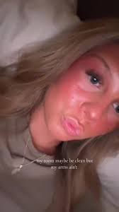 Emo Cringe: My Room vs. My Arms