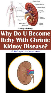 Ridiculous Ideas Can Change Your Life What Is Fsgs Kidney Disease Arizona Kidney D Polycystic Kidney Disease Kidney Disease Awareness Kidney Disease