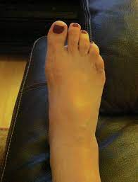 Reasonably Well Who Put A Marble In My Shoe