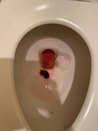 This is because a baby is thought to have a good chance of surviving if they are born alive at 24 weeks. Any Experience With Miscarriage Graphic Image Alert May 2020 Babies Forums What To Expect