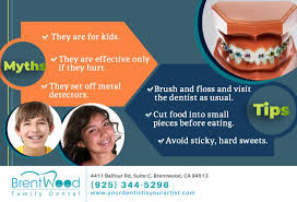 There Are Many Myths About Braces That May Scare You Off From Wearing Them Talk To Your Orthodontist At 925 344 5296 Family Dental Dental Health Dental