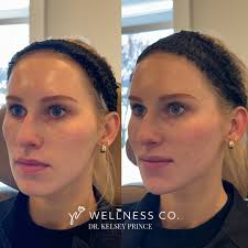 Kelsey Prince DNP, FNP-BC