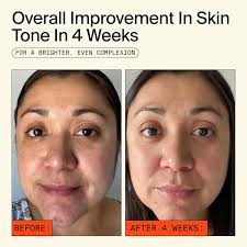 Juventude para as Pessoas