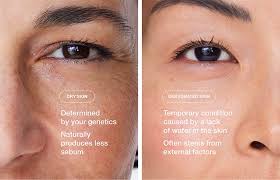 Image result for Dry Skin