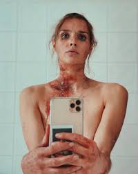 Camille Lou ensanglantée : ce cliché choc qui a fait peur à ses fans...