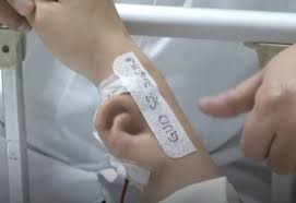 Jangan Kaget Telinga Tumbuh Di Lengan Ini Kisah Nyata Chinese Man Ear Man