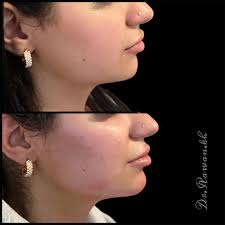 Dr. Rawan Alkhateeb د.روان هشام الخطيب