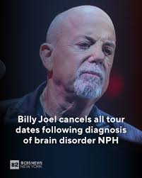 Billy Joel's wife, Alexis Roderick Joel, broke her silence following the  cancellation of his tour due to his diagnosis with normal pressure  hydrocephalus. She shared a heartfelt snap with their daughters, Della