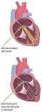 Image result for i have complete heart block for 20 years caused by lyme disease what is the treatment