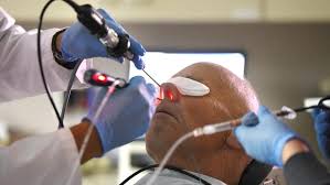 Image result for Sinus Surgery