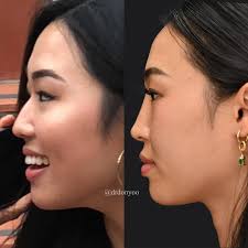 Donald B. Yoo, M.D., Inc.