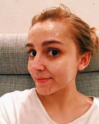 Hannah Witton