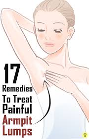 13 Home Remedies To Reduce Armpit Lumps Armpit Lump Swollen Lymph Nodes Epidermoid Cyst