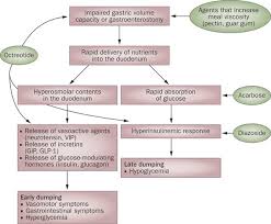 Pathophysiology Diagnosis And Management Of Postoperative Dumping Syndrome Nature Reviews Gastroenterology Hepatology