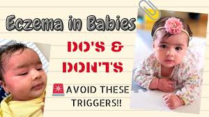 But if your baby isn't getting enough sleep because the itching from her eczema is always keeping her awake at night. Eczema In Babies Best Products That Work Before After How To Stop Itching Why Are Babies Fussy Youtube