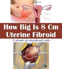 Foods full of sugar and starch, such as bread, pasta, rice, and potatoes, should be avoided. Pin On Fibroid Vitamin D