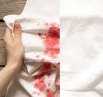 Cómo quitar manchas de sangre en la ropa | Estilo de vida ...