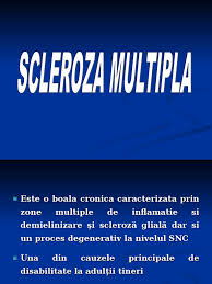 Noi sperante pentru pacientii diagnosticati cu scleroza multipla: Scleroza Multipla
