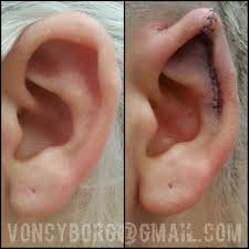 Besides good quality brands, you'll also find plenty of discounts when you shop for elf ears during big sales. Ear Pointing Amazing Anetavoncyborg Artist Bme Bodymodification Bodymods Bodyart Bodmod Bestoftheday Bodymod B Body Mods Elf Ears Body Modifications