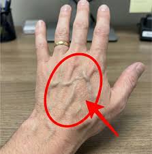 If you have visible veins, it means you are... See more👇💬