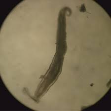 Image result for Pinworm