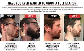 It's just very soft and sparse. The King Beard Growth Kit Facial Hair Care 4 Pcs Set With Activator Serum Beard Roller Sanitizer Travel Comb Amazon Co Uk Health Personal Care