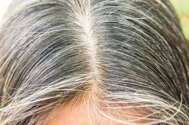 Alternatively, mix bhringraj powder with water to create a thick paste. Home Remedies For Grey Hair à¤¸à¤« à¤¦ à¤¬ à¤² à¤• à¤‡à¤² à¤œ à¤¸à¤« à¤¦ à¤¬ à¤² à¤• à¤¤ à¤²