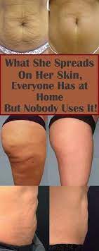 Pin On Miracle Bum Bum How To Get Rid Of Cellulite
