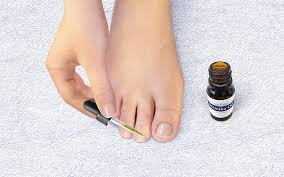 Let us see some remedies. Don T Let Toenail Fungus Spoil Your Flip Flop Season Spy