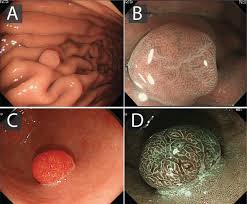 The stomach is a muscular sac located in the upper middle of your if you have signs and symptoms that worry you, make an appointment with your doctor. British Society Of Gastroenterology Guidelines On The Diagnosis And Management Of Patients At Risk Of Gastric Adenocarcinoma Gut
