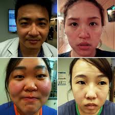 我們以前就這樣了” 因為台灣健保的制度護理師永遠都是被壓榨最最最底層的一群生病了，不敢請假怕人力不夠接病人忙到一口水都沒喝，