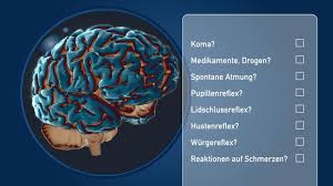Die sogenannte leichstarre, auch totenstarre und lateinisch rigor mortis genannt tritt ein. Der Warme Tod
