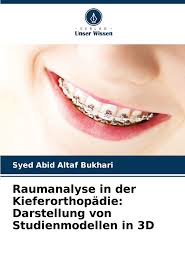 Raumanalyse in der Kieferorthopädie: Darstellung von Studienmodellen in 3D"  online kaufen