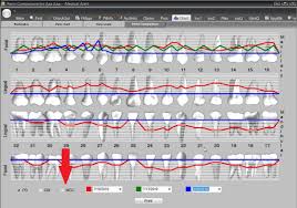 Dental Management Software Compare Recession And Mgj In