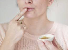 10 Essential Oils For Cold Sores Benefits And Uses