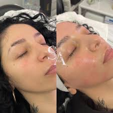 Reviews of Syree Aesthetics