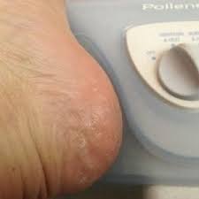 2,525 likes · 4 talking about this. Does The Listerine Foot Soak Really Work Creative Homemaking