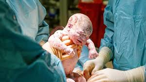 Bayi lahir januari jadi bos. 5 Penyebab Bayi Lahir Cacat Beserta Faktor Risikonya
