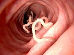 Tapeworms Causes Symptoms And Treatments