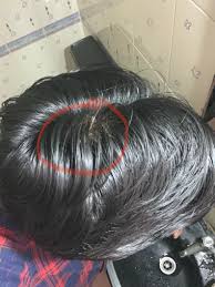 ist es ein haarausfall zeichen ich erlebe als solches nichts und meine haare sind hier einge haare orange haare haarausfall