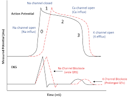 Image result for QT Interval