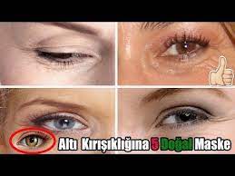 Goz Alti Kirisikliklari Icin Maske Goz Alti Kirisikliklari Icin Dogal Yontemler Youtube Youtube Gozler 30 Yasinda