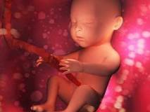 What happens if baby poops in womb?