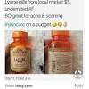 This study suggest that lysine, in combination with arginine may be useful for this type of hair loss as well. Https Encrypted Tbn0 Gstatic Com Images Q Tbn And9gcstk Ycupqnkze2aw6kyfczwoc0o8nhx8jglr1uxyejl3zvsjxe Usqp Cau